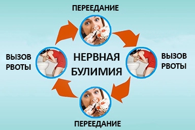 Лечение булимии в Рефтинском